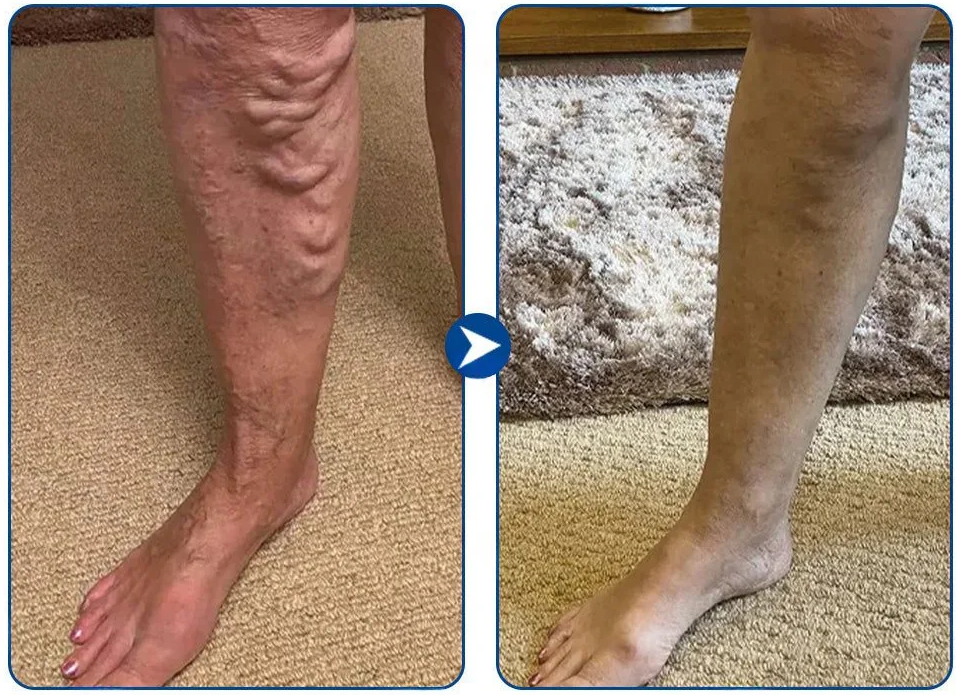 Femme souriante, jambes lisses, dans son salon