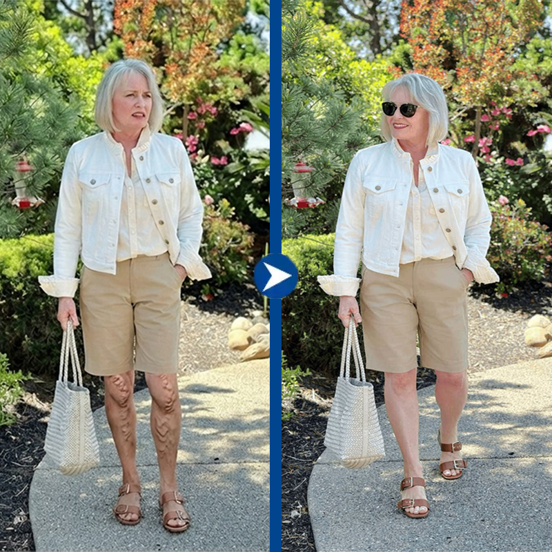 Femme avant et après utilisation de VenoErase, jambes lisses