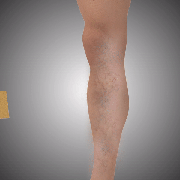 Femme massant son mollet douloureux